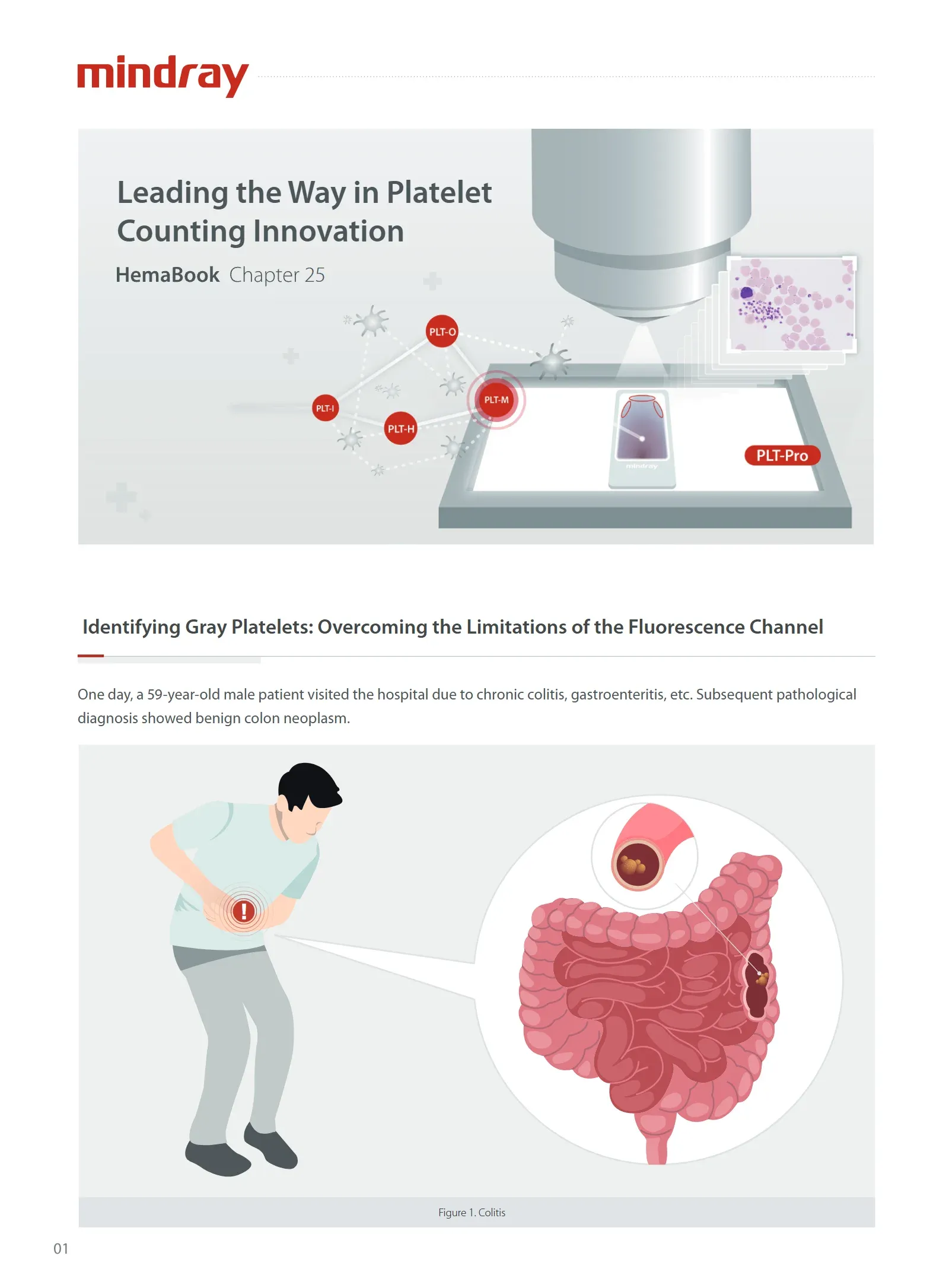 platelet-count-innovation-leader-1.0-en-001.webp