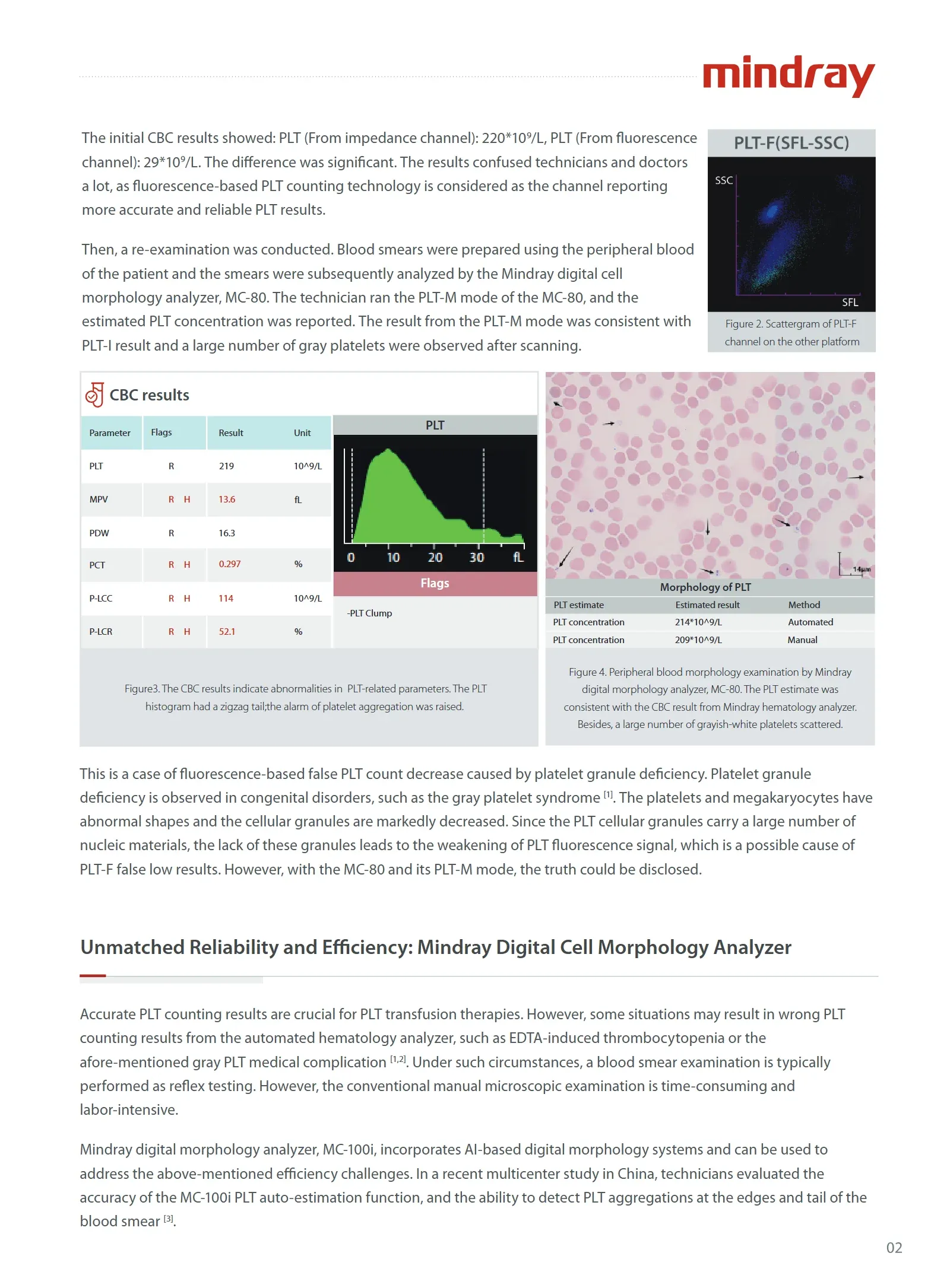 platelet-count-innovation-leader-1.0-en-002.webp